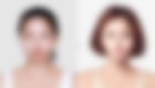 河南大学附属南石医院烧伤整形美容中 心擅长项目