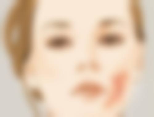丁浩医生擅长的项目