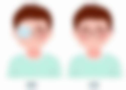 南京新视力擅长项目。