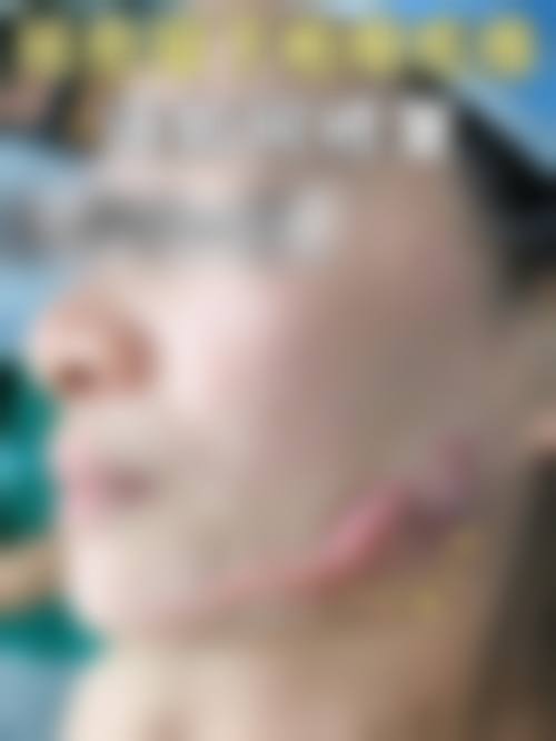 南京瑞鑫烧伤医院预约挂号方式。