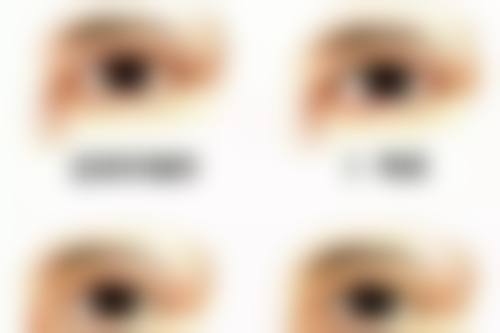 宝鸡第三医院眼科预约挂号方式。