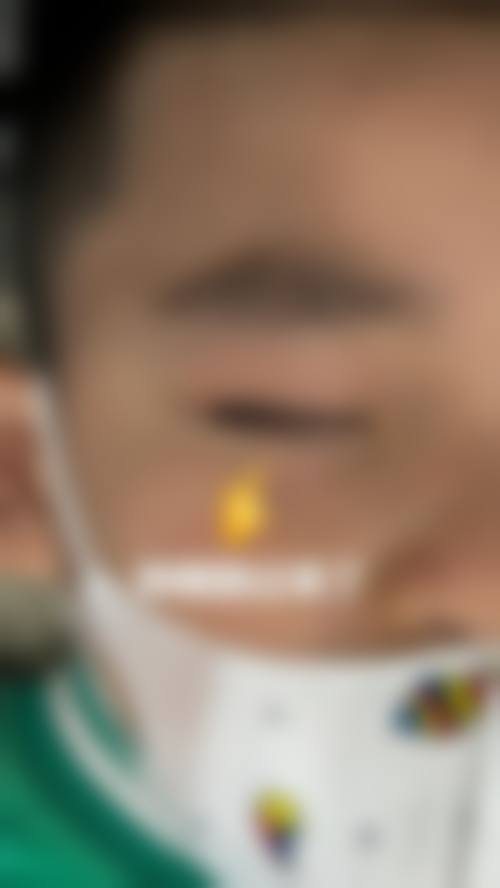 宝鸡第三医院眼科门诊营业时间。