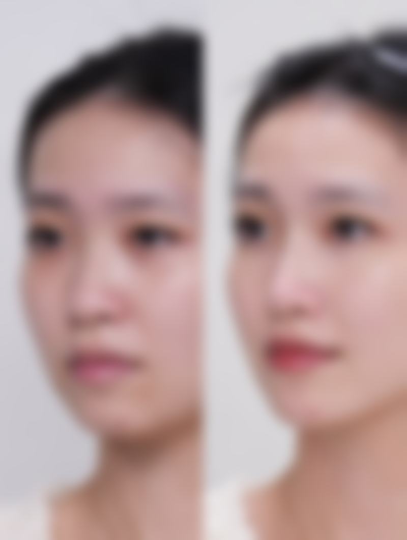 金圣珉擅长的治疗项目