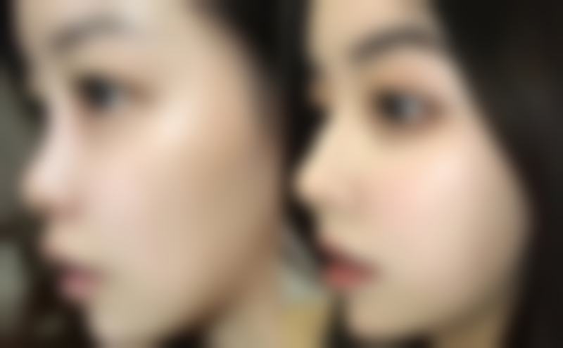 丁浩医生的技术实力