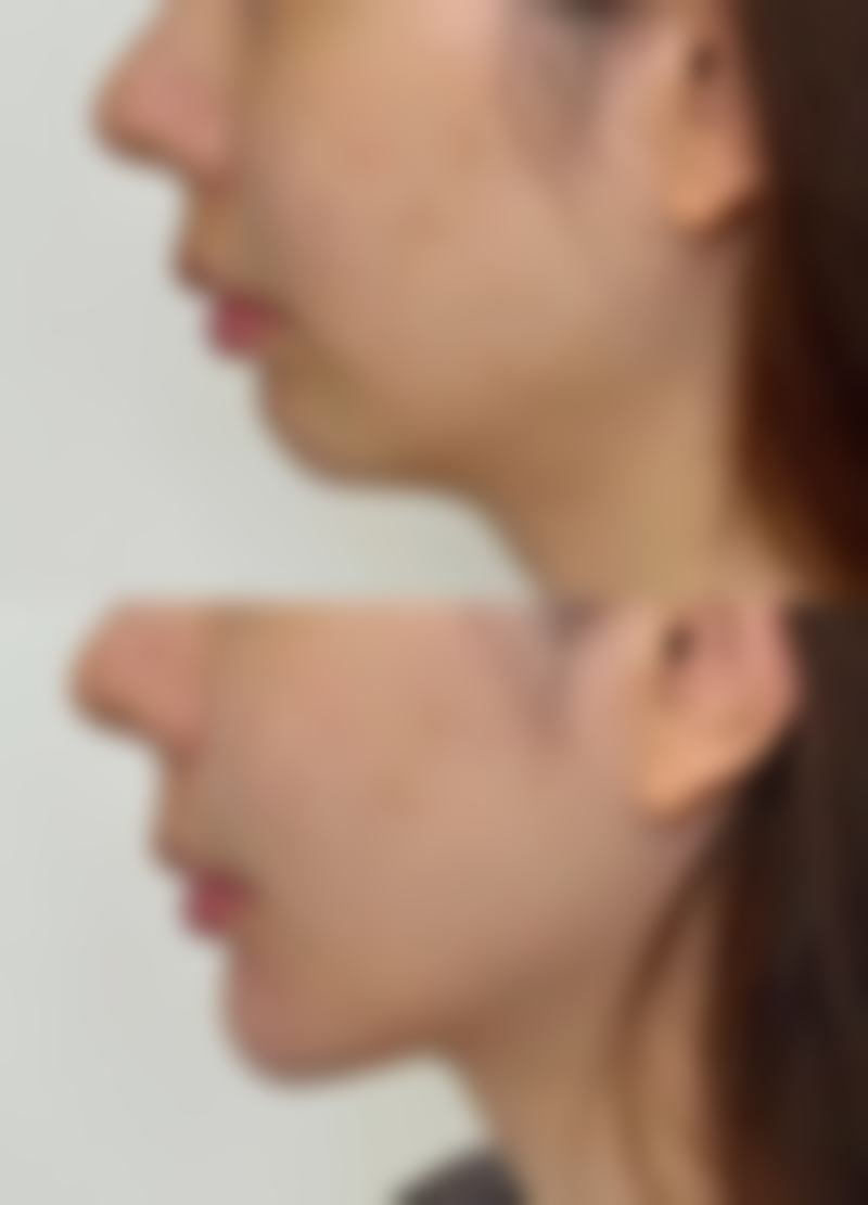 金圣珉的技术实力体现