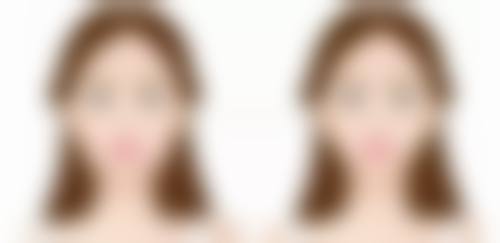 南京艺颜整形医院擅长项目。