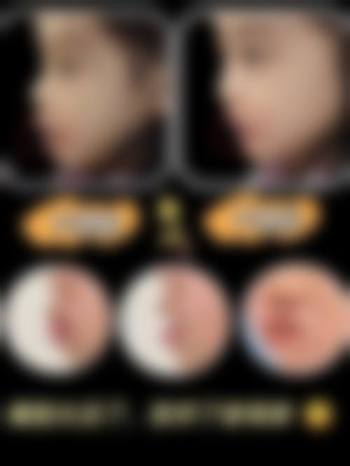 东莞大朗松佛恒生口腔门诊部擅长项目。