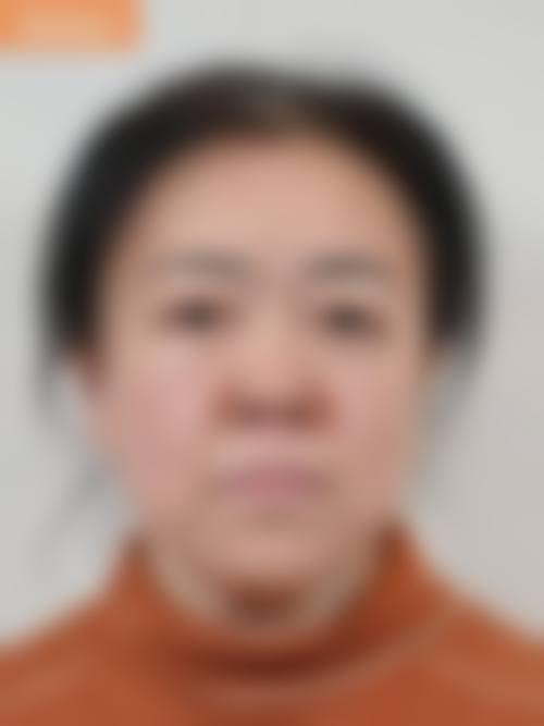深圳（惠州）倍生植发2026年价格收费表：