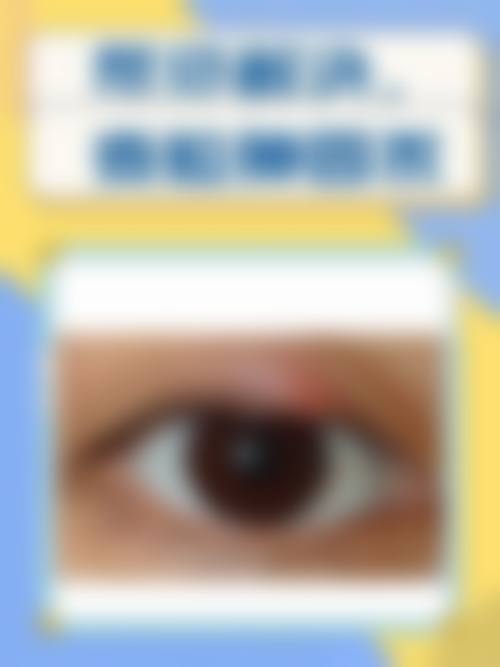 重庆市第五人民医院眼科医生团队经验稳定。