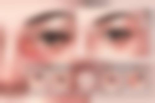 山东省鲁南眼科医院整形科治疗反馈与口碑评价。