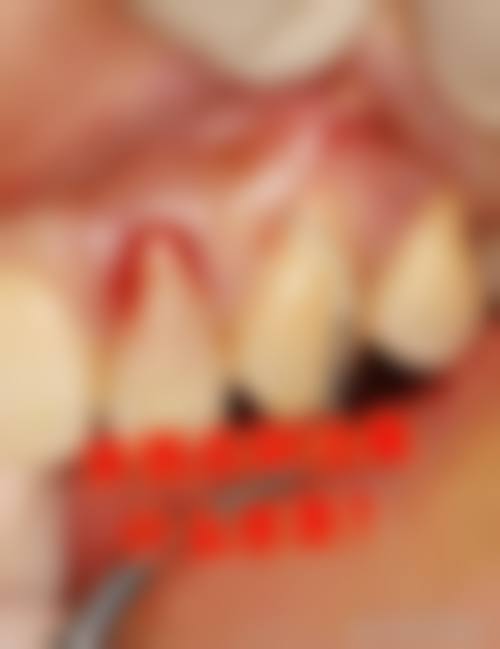 浙江温州平阳宋俊杰口腔治疗反馈与口碑评价。