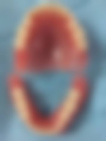 深圳鑫星口腔诊所治疗反馈与口碑评价。