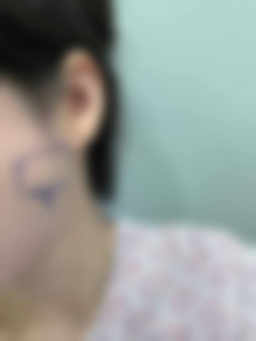 南京天际美容诊所治疗反馈与口碑评价。