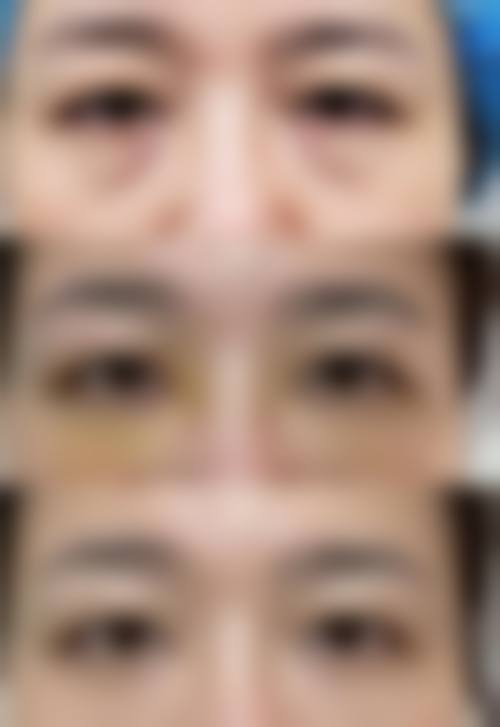 永年李婷医院整形科治疗反馈与口碑评价。