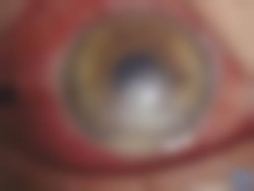 广州番禺眼管家眼科门诊部门诊营业时间。