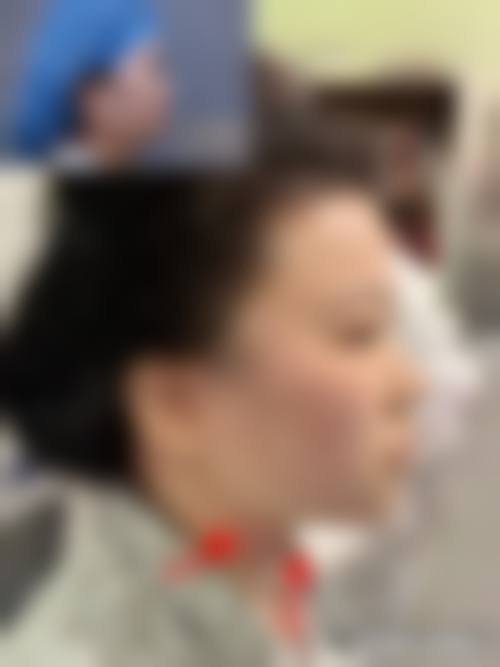 刘春燕医生擅长项目