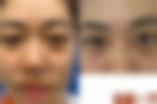 长沙宇美医疗美容门诊部擅长项目。