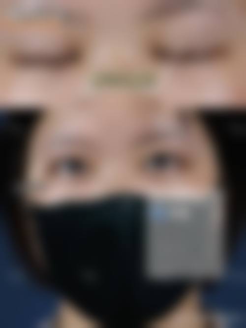 长沙宇美医疗美容门诊部医生团队经验稳定。
