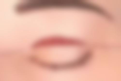 西安中 心医院烧伤整形科擅长项目