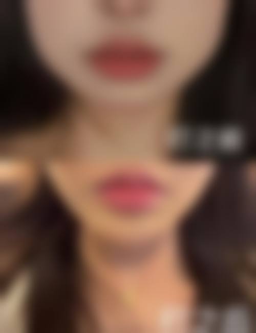 合阳县柠檬树整形医院门诊营业时间