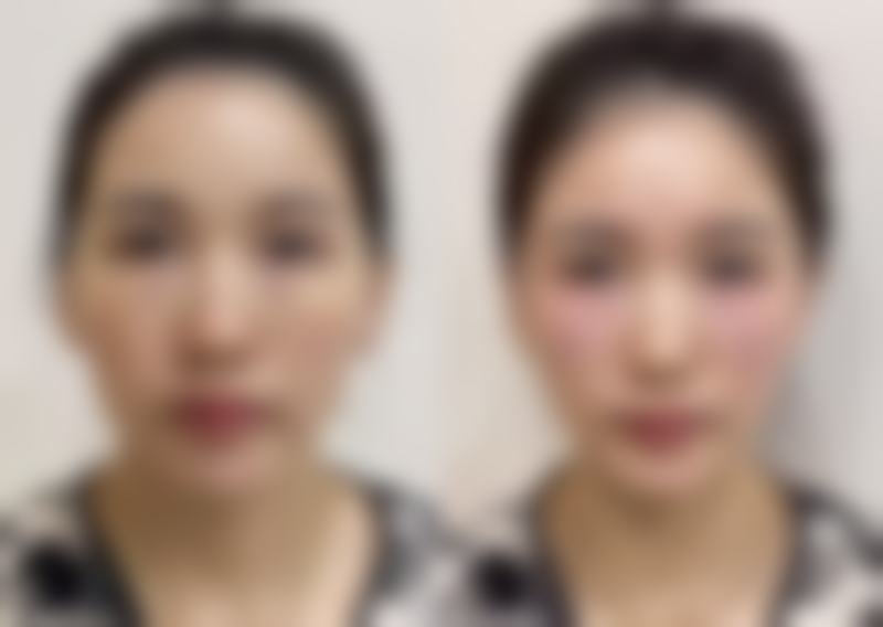赵瑾医生擅长的治疗项目