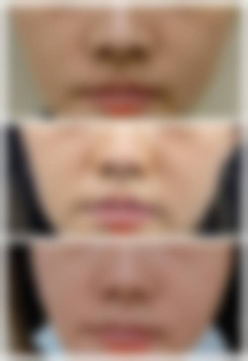 湖北省人民医院整形烧伤外科预约挂号方式。