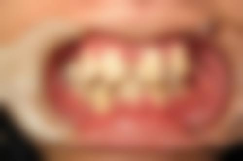 巴彦淖尔市魏宝成口腔诊所医生团队经验稳定。
