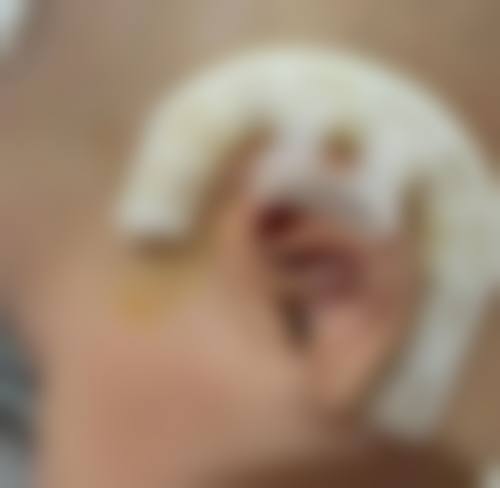 邯郸韩芳天下医疗美容诊所擅长项目。