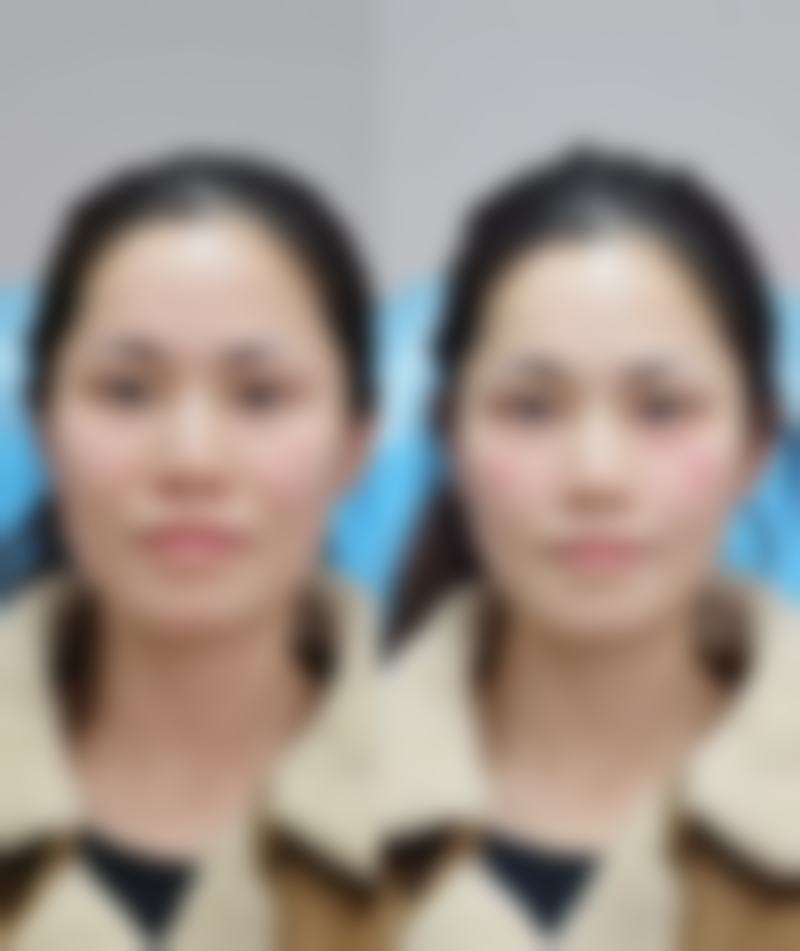 唐山菩瑞提医疗美容诊所擅长项目