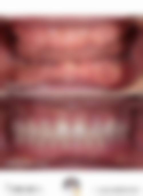 郑州巩义阳光医院口腔科医生团队经验稳定。