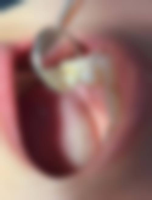 六、甘肃白银佳美口腔诊所口碑如何?
