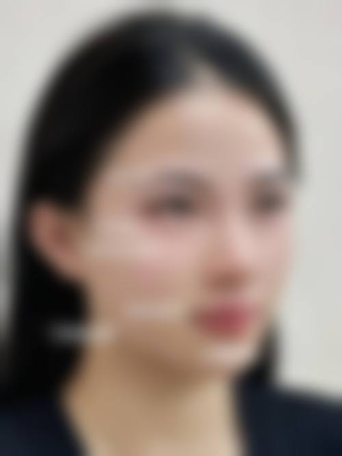 西安健丽医美的项目价格