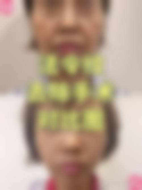 常熟瑞丽医院整形科预约挂号方式。