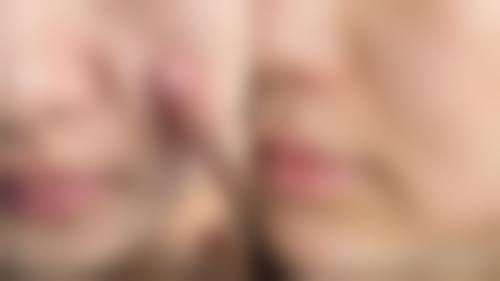 常熟瑞丽医院整形科治疗反馈与口碑评价。