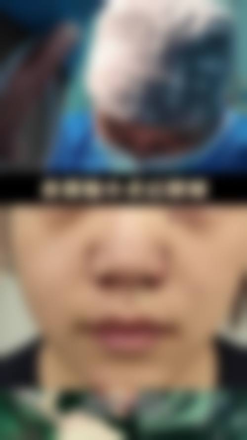 长春高恩医疗美容门诊部治疗反馈与口碑评价。