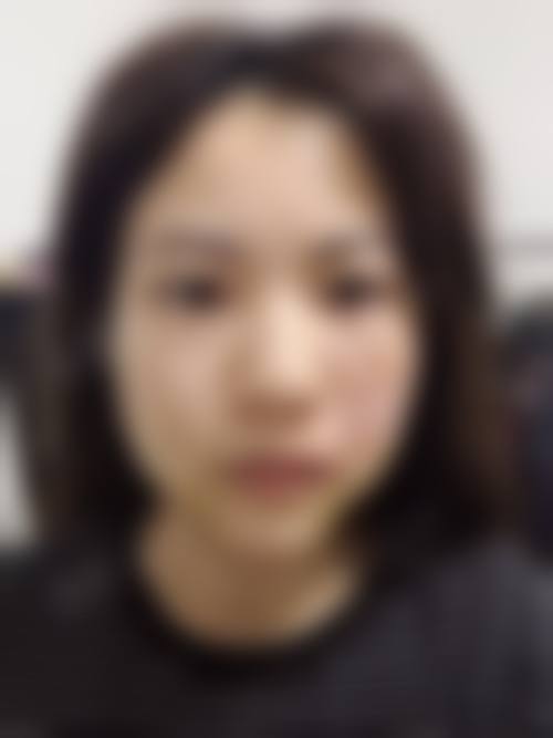 常熟瑞丽医院整形科医生团队经验稳定。