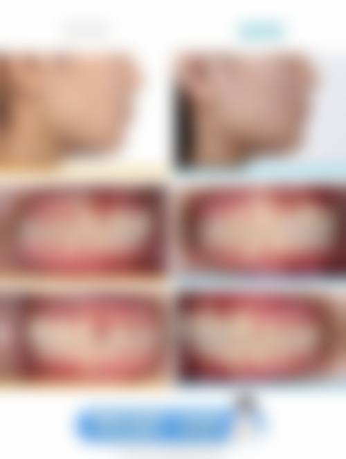 台州新维口腔治疗反馈与口碑评价。