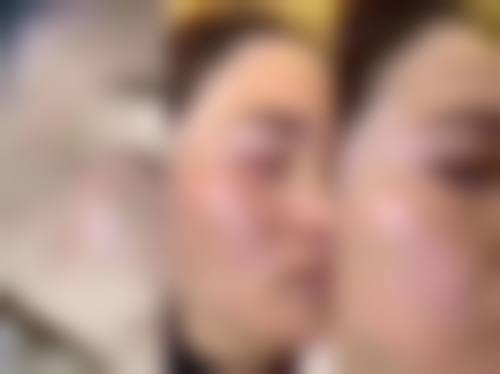 内蒙古呼和浩特紫洁一科整形医院擅长项目。