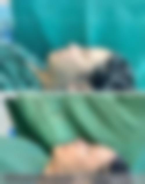 鞍山医美莱医疗美容诊所擅长项目。