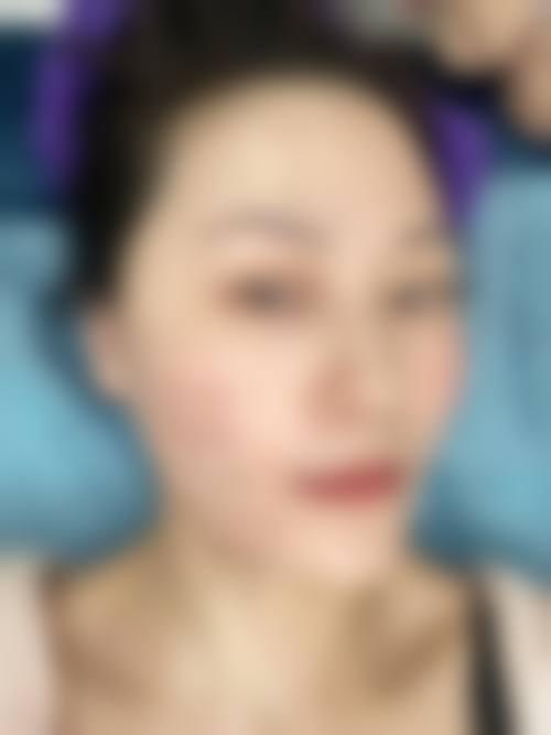 内蒙古呼和浩特紫洁一科整形医院治疗反馈与口碑评价。
