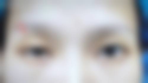 莆田华厦眼科门诊营业时间。
