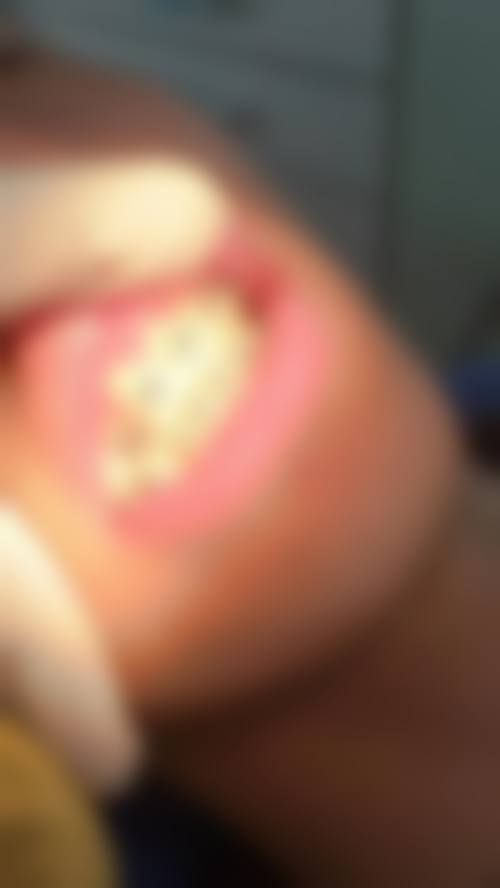 浙江绍兴诸暨复大口腔擅长项目。