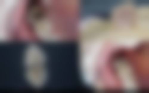 温州泰康拜博口腔擅长项目有哪些？