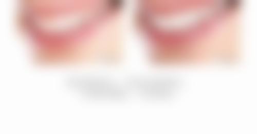 邯郸齐心口腔预约挂号方式