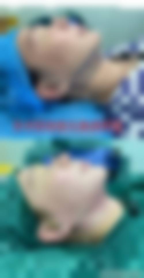 四川大学华 西口腔医院(唇腭裂外科)预约挂号方式。