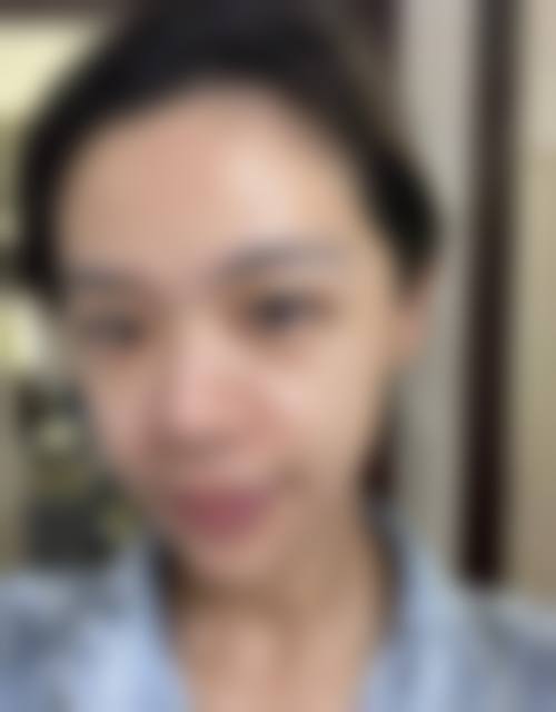 阆中九州华昀九韵整形医院擅长项目。