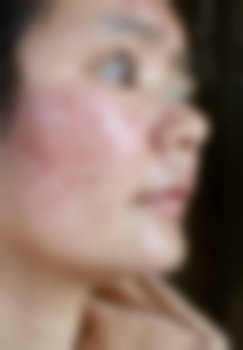 Lucia Clinic 横滨预约挂号方式。