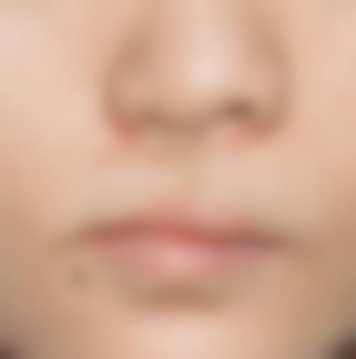 莆田学院附属医院整形美容科擅长项目。