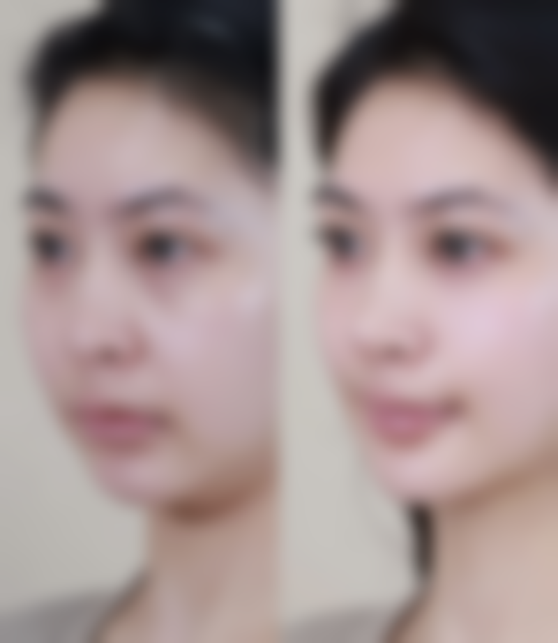 Lucia Clinic 横滨治疗反馈与口碑评价。