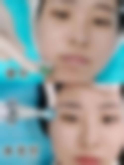 银川市慧顶医学美容诊所擅长项目。